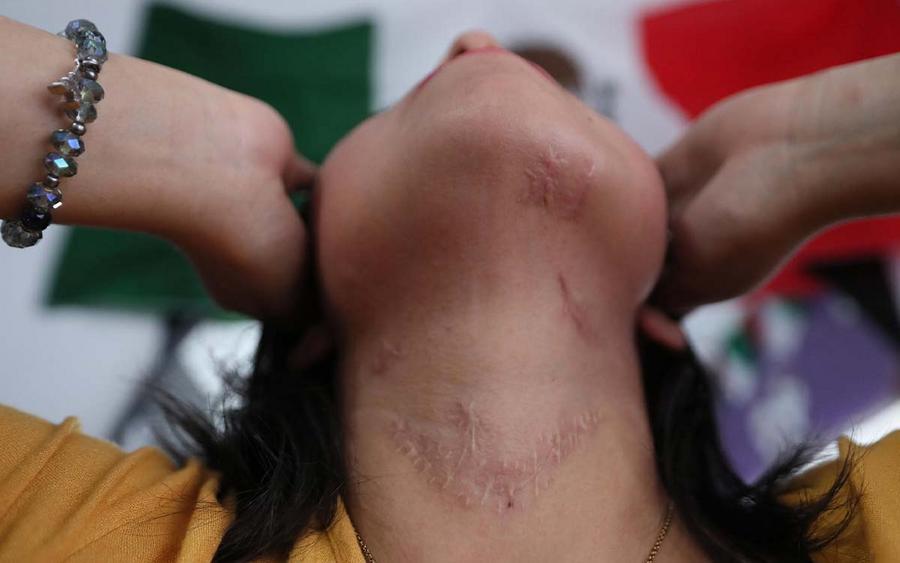 cicatricez-viva-victima-feminicidio-15092023